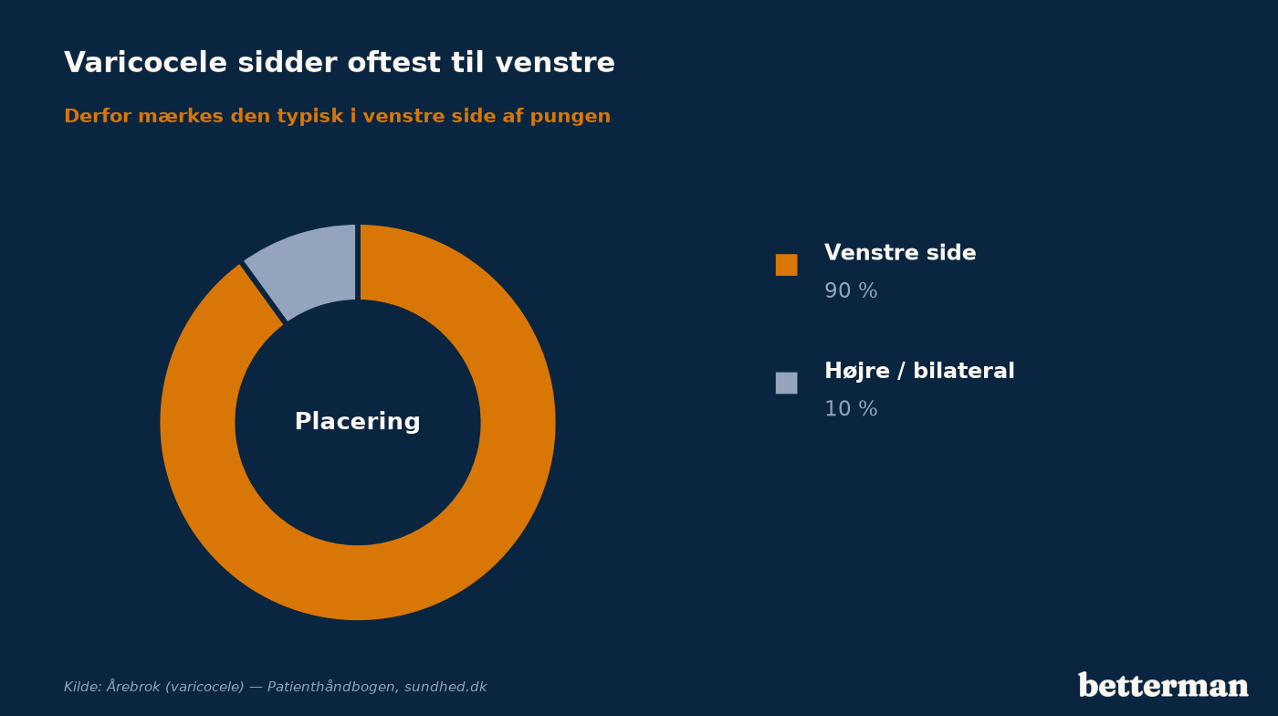 Varicocele sidder oftest til venstre og inddeles efter hvor udtalt den er